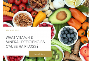 What Vitamin and Mineral Deficiencies Cause Hair Loss?