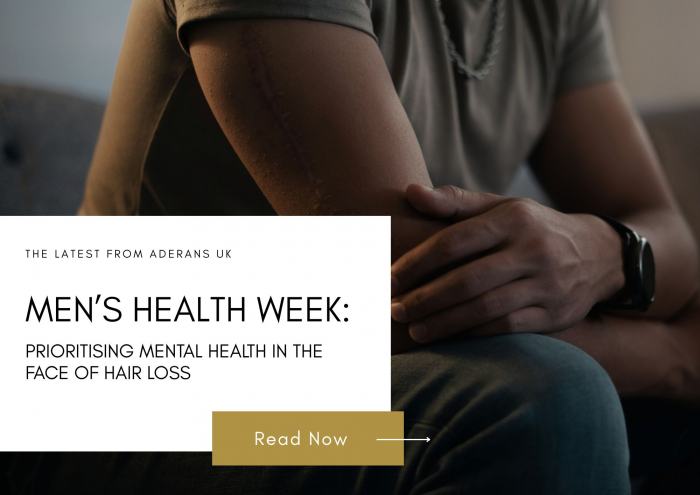 Men’s Health Week: Prioritising Mental Health in the Face of Hair Loss