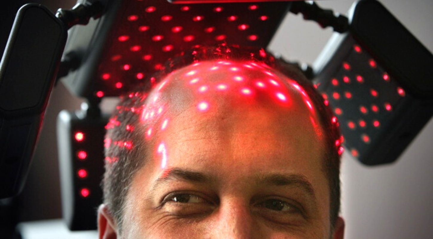 Can Light Therapy Help With Hair Loss Scalp Problems 1  
